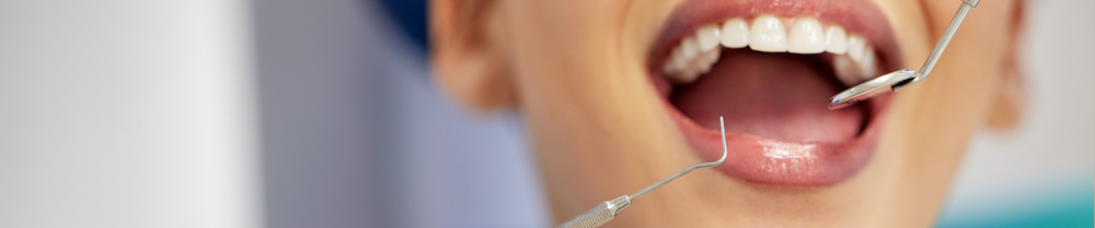 Bad Breath Causes: It’s Not Just What You Ate